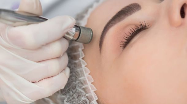 Diamant-Mikrodermabrasion im Gesicht – sanftes Peeling für strahlende Haut.